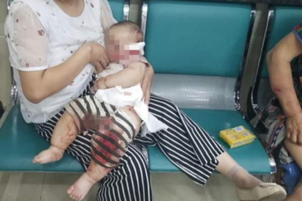 20cm长的棉签在晚上有什么用处 示例图 - 说明文字